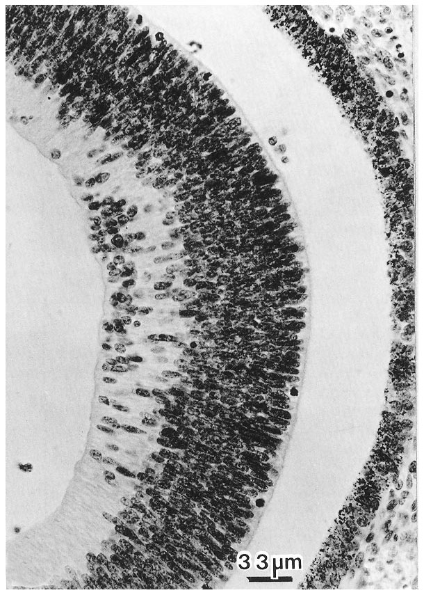 Photomicrograph of the eye full size